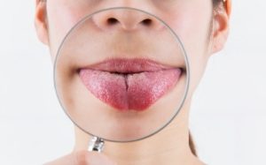 知ってますか？口唇ヘルペスはうつる！？病院で正しい治療を！早めの薬を！